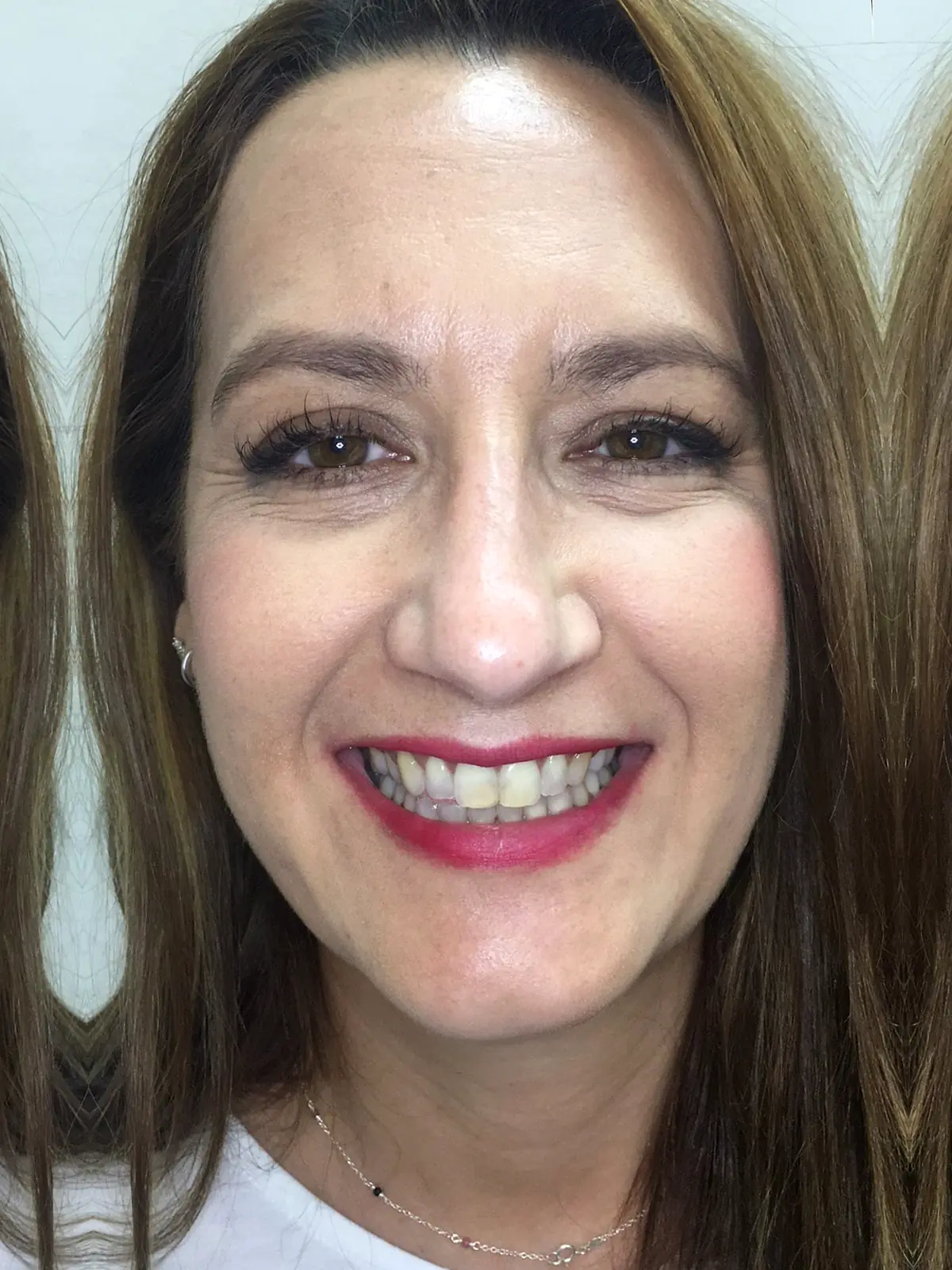 Estado inicial antes del tratamiento dental