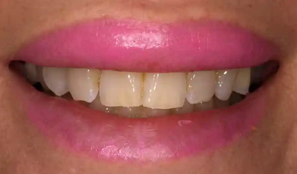 Estado inicial antes del tratamiento dental