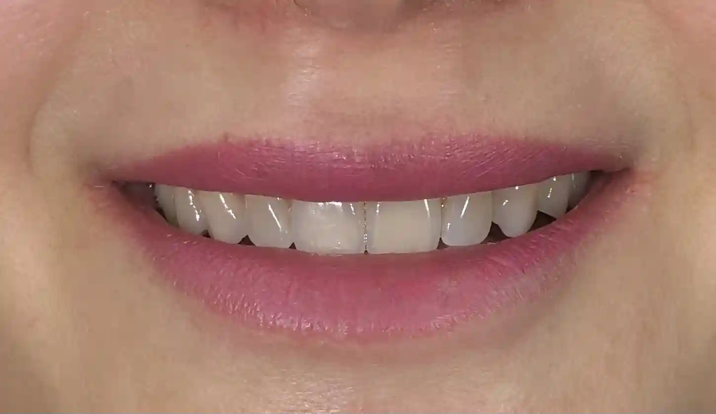 Estado inicial antes del tratamiento dental