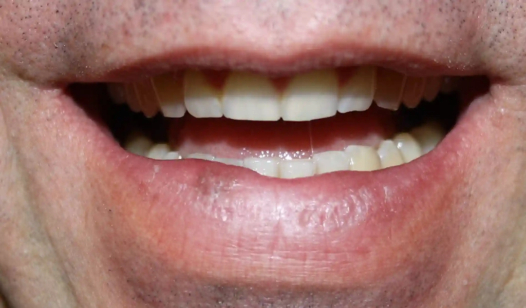Estado inicial antes del tratamiento dental