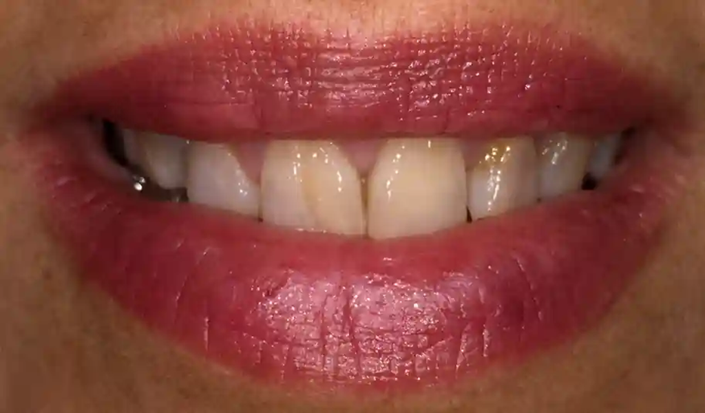 Estado inicial antes del tratamiento dental