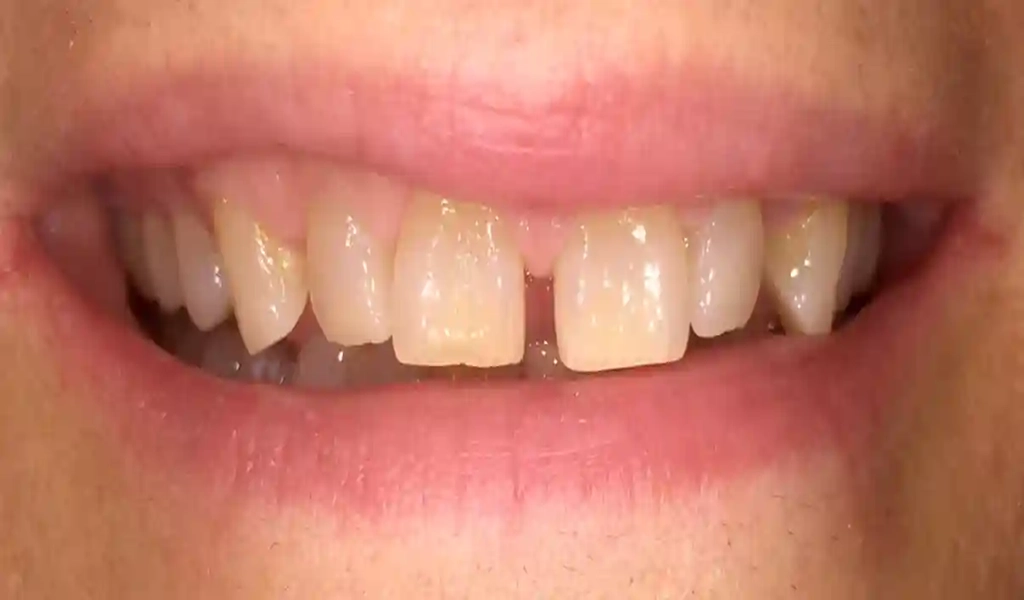 Estado inicial antes del tratamiento dental