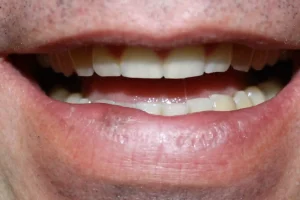 Inicial Sonrisa