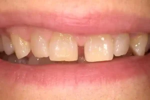 Inicial sonrisa