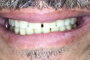 Inicial-sonrisa-7-