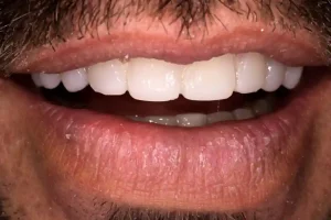 Mock up sonrisa