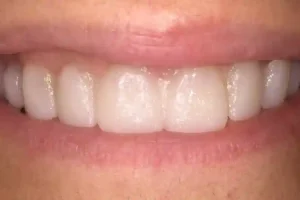 Mock up sonrisa